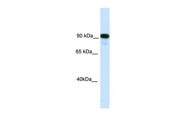 CIITA Antibody in Western Blot (WB)