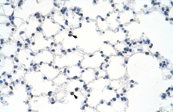 MYBBP1A Antibody in Immunohistochemistry (IHC)