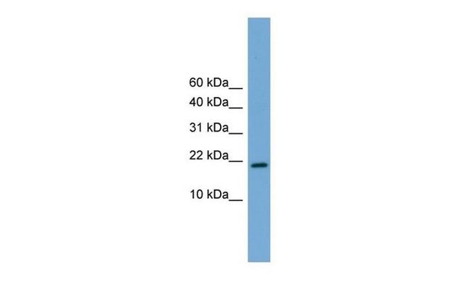 CITED4 Antibody in Western Blot (WB)
