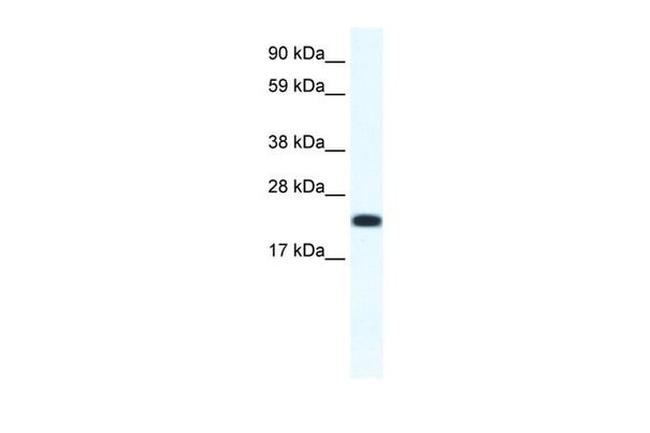 CITED4 Antibody in Western Blot (WB)