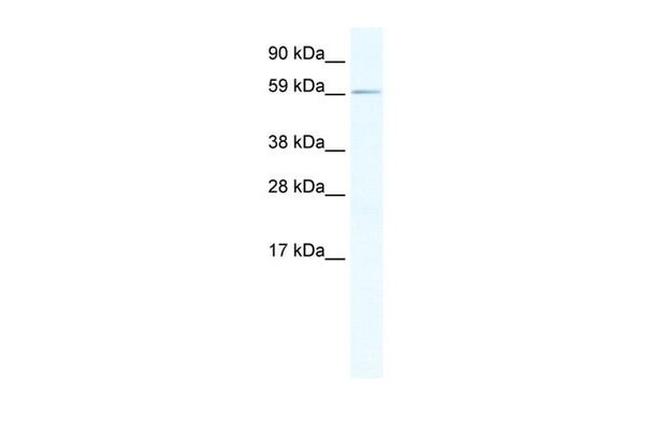 RBM14 Antibody in Western Blot (WB)