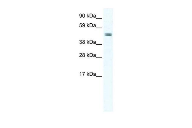 ELP4 Antibody in Western Blot (WB)