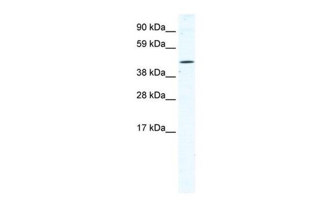 TTC19 Antibody in Western Blot (WB)