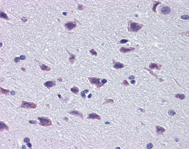 DMBX1 Antibody in Immunohistochemistry (IHC)