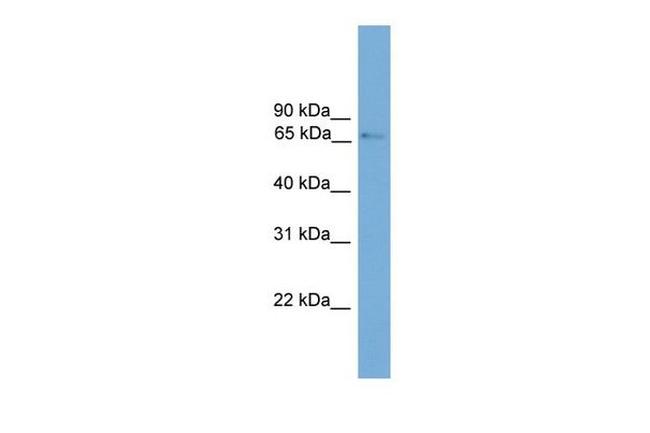 PROX2 Antibody in Western Blot (WB)