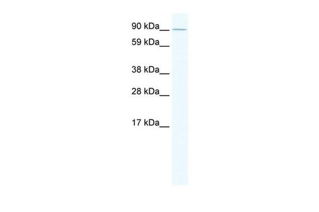 E2F7 Antibody in Western Blot (WB)