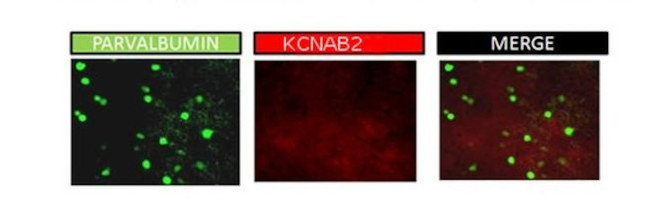 KVbeta2 (KCNAB2) Antibody in Immunohistochemistry (IHC)