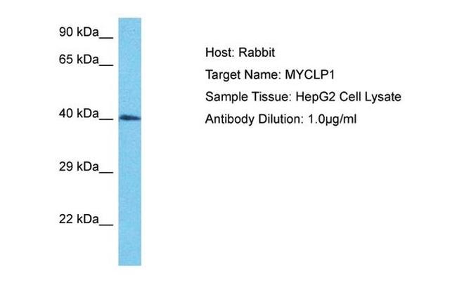 MYCLP1 Antibody in Western Blot (WB)