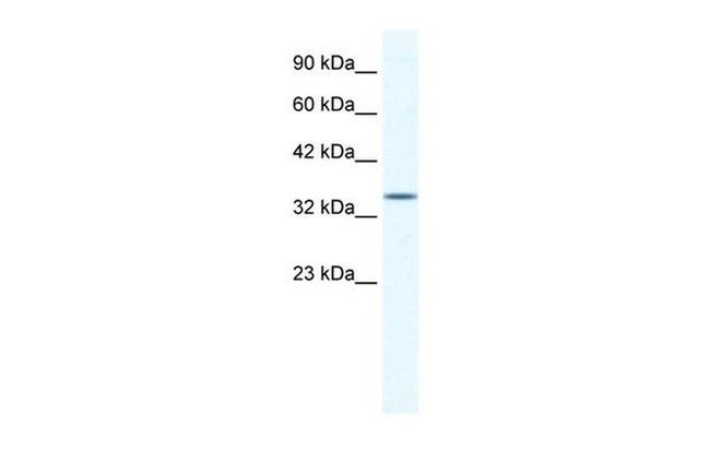 ZNF589 Antibody in Western Blot (WB)