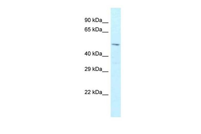 Zfp872 Antibody in Western Blot (WB)