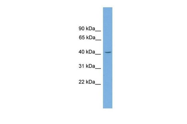 GATA5 Antibody in Western Blot (WB)