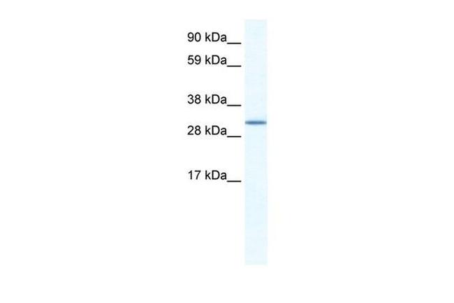 SPIC Antibody in Western Blot (WB)