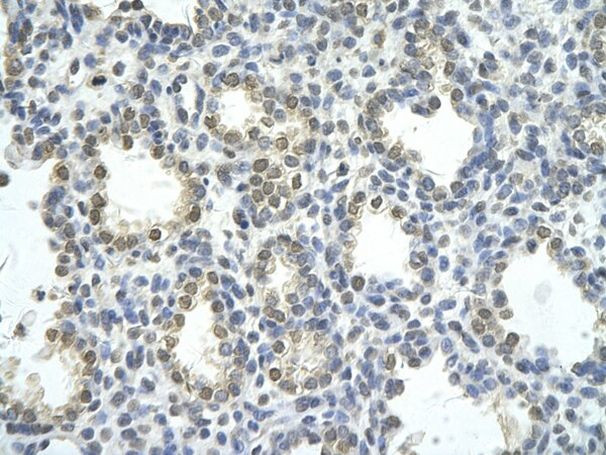 ZNF264 Antibody in Immunocytochemistry (ICC/IF)