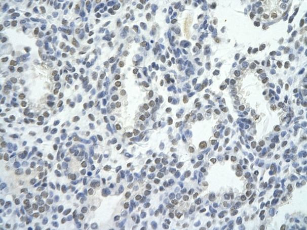 ZNF264 Antibody in Immunocytochemistry (ICC/IF)