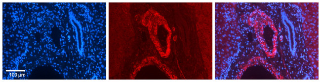 ZFP36L1 Antibody in Immunohistochemistry (Paraffin) (IHC (P))