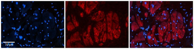 ZFR Antibody in Immunohistochemistry (Paraffin) (IHC (P))