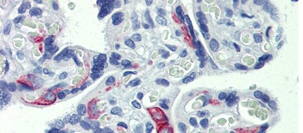 ZNF71 Antibody in Immunohistochemistry (Paraffin) (IHC (P))