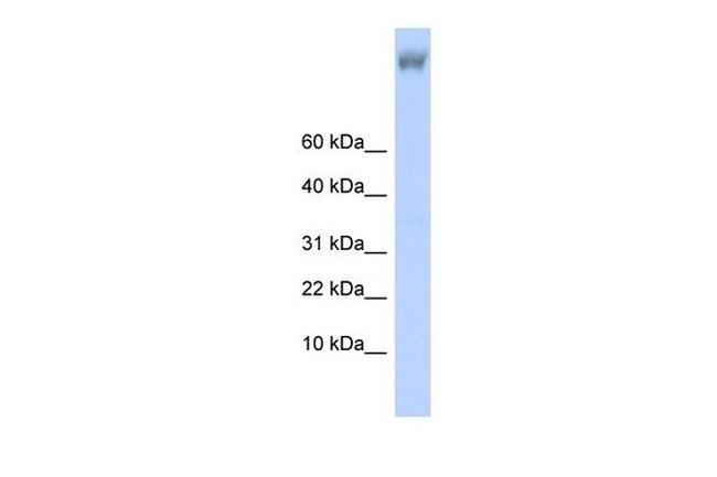 ZNF644 Antibody in Western Blot (WB)