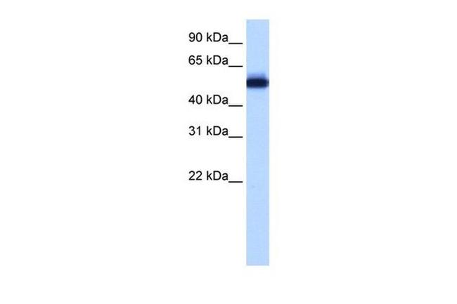 ZFP82 Antibody in Western Blot (WB)