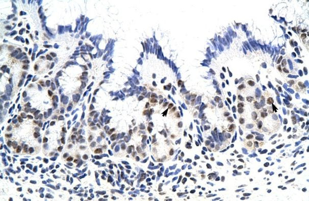 ZNF296 Antibody in Immunohistochemistry (IHC)