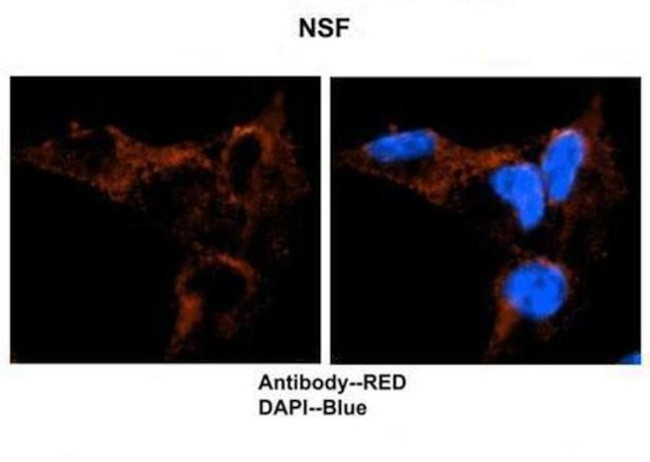 NSF Antibody in Immunohistochemistry (IHC)