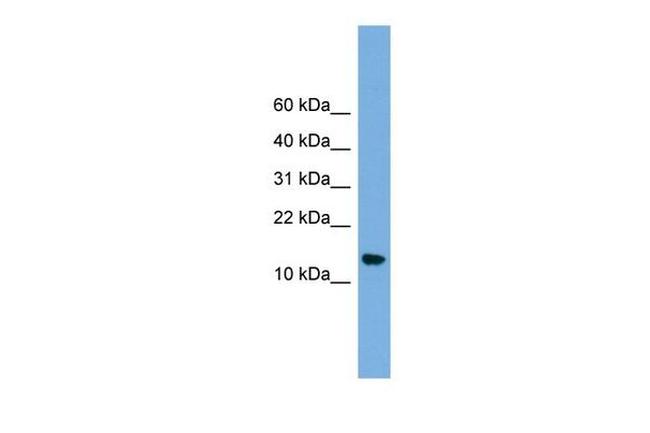 LSM8 Antibody in Western Blot (WB)