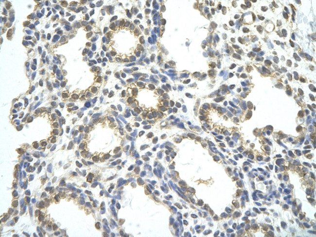 RBM26 Antibody in Immunohistochemistry (Paraffin) (IHC (P))