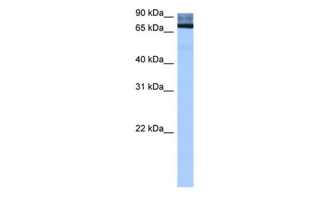 ADAD2 Antibody in Western Blot (WB)