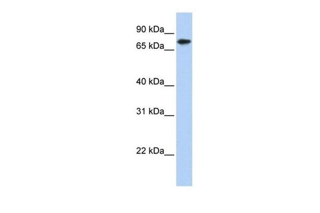 KLHL23 Antibody in Western Blot (WB)