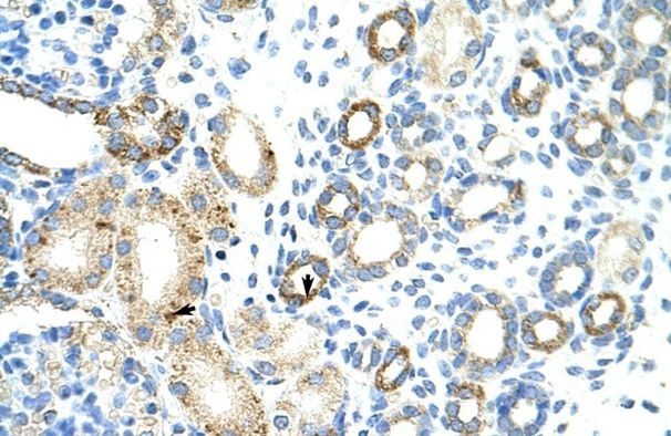 RBM46 Antibody in Immunohistochemistry (Paraffin) (IHC (P))