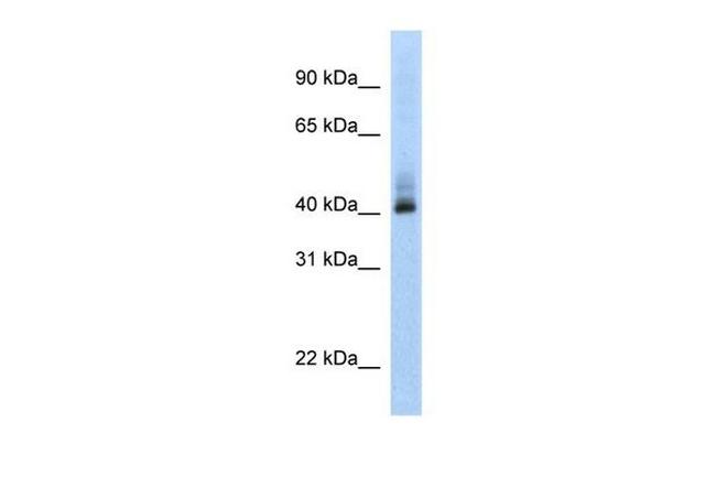 ANKRD42 Antibody in Western Blot (WB)