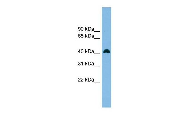 ANKRD42 Antibody in Western Blot (WB)