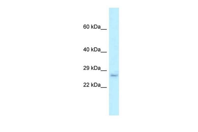 EVA1B Antibody in Western Blot (WB)