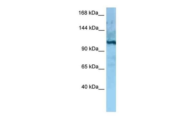 MORC4 Antibody in Western Blot (WB)