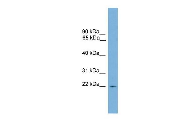 RGS10 Antibody in Western Blot (WB)