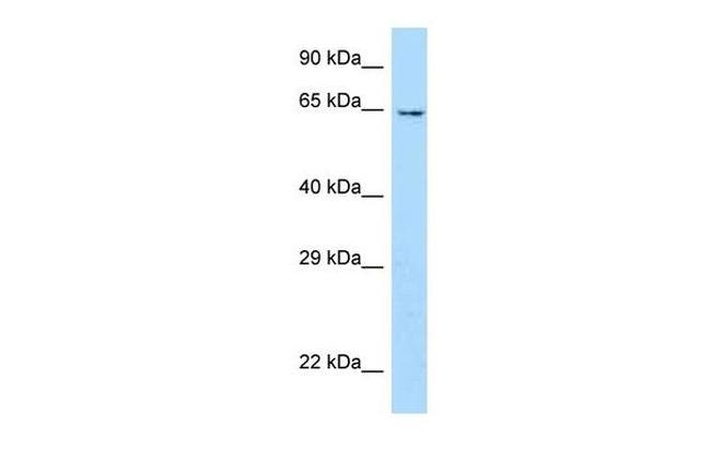 UBOX5 Antibody in Western Blot (WB)