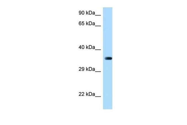 MARCH2 Antibody in Western Blot (WB)