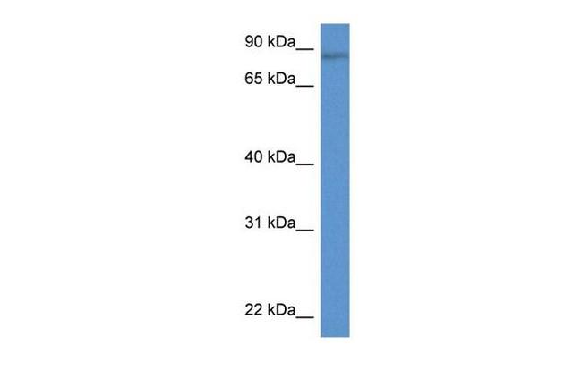 TRIM36 Antibody in Western Blot (WB)