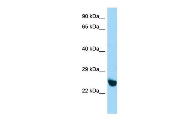 UNKL Antibody in Western Blot (WB)
