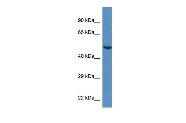 RNF92 Antibody in Western Blot (WB)