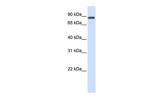 HECTD2 Antibody in Western Blot (WB)