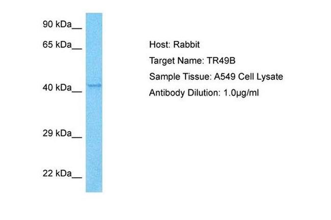TRIM49B Antibody in Western Blot (WB)
