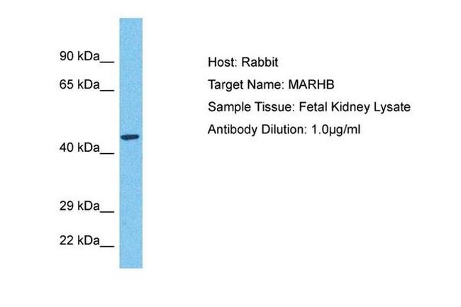 MARCH11 Antibody in Western Blot (WB)