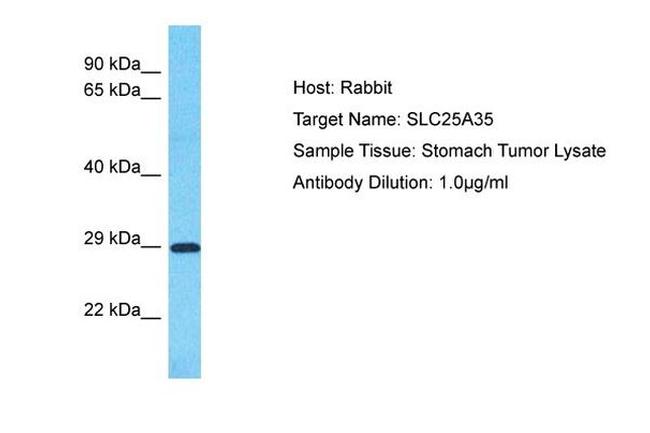 SLC25A35 Antibody in Western Blot (WB)
