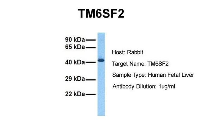 TM6SF2 Antibody in Western Blot (WB)