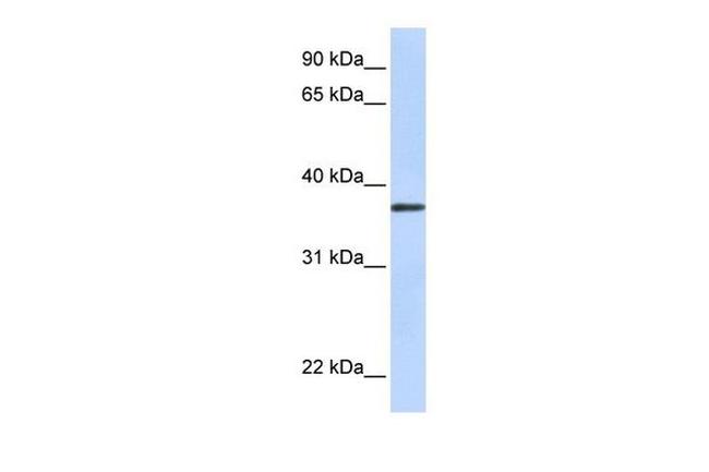 TMEM200B Antibody in Western Blot (WB)