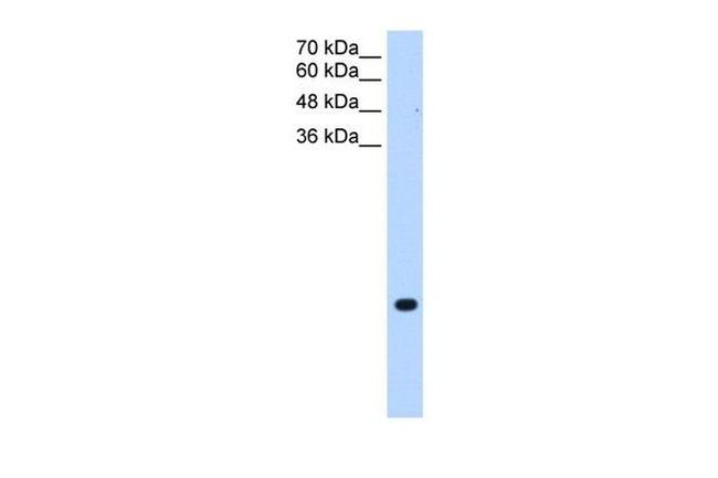 TMEM75 Antibody in Western Blot (WB)