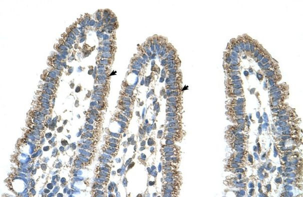CPS1 Antibody in Immunohistochemistry (IHC)