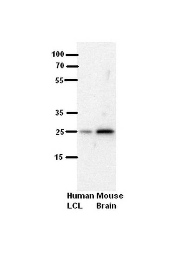 SH3BGR Antibody in Western Blot (WB)