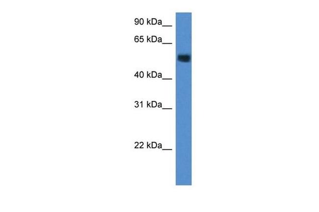 CHST2 Antibody in Western Blot (WB)